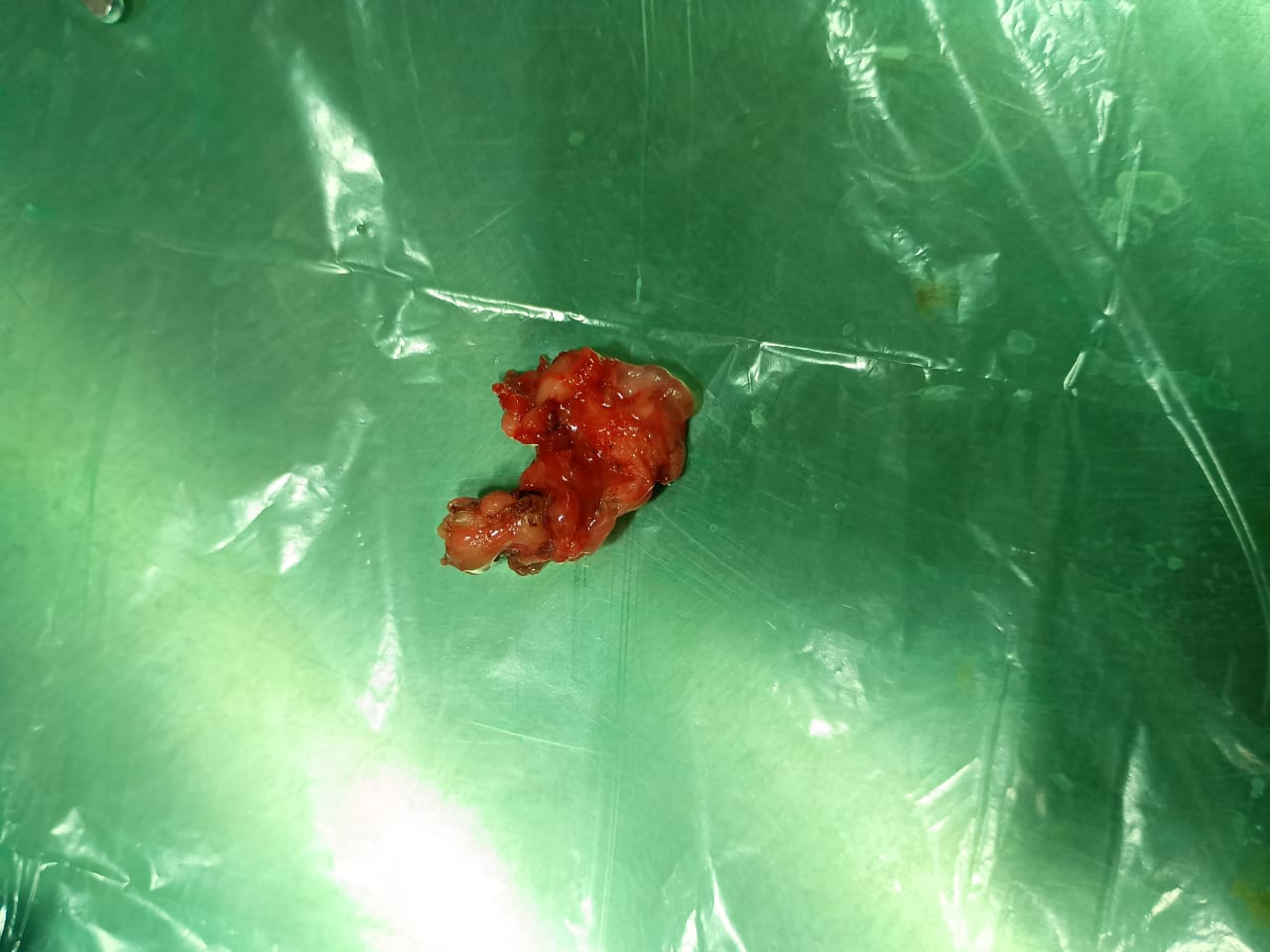 surgery-7